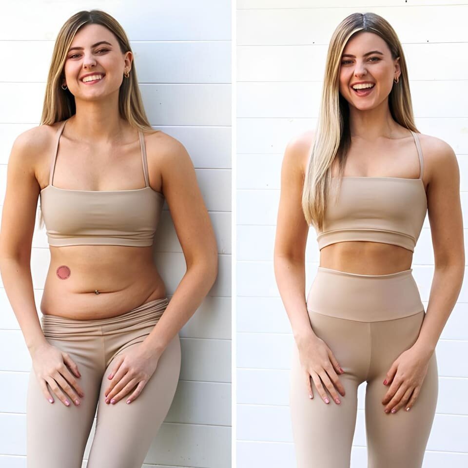 Purelora Patches image